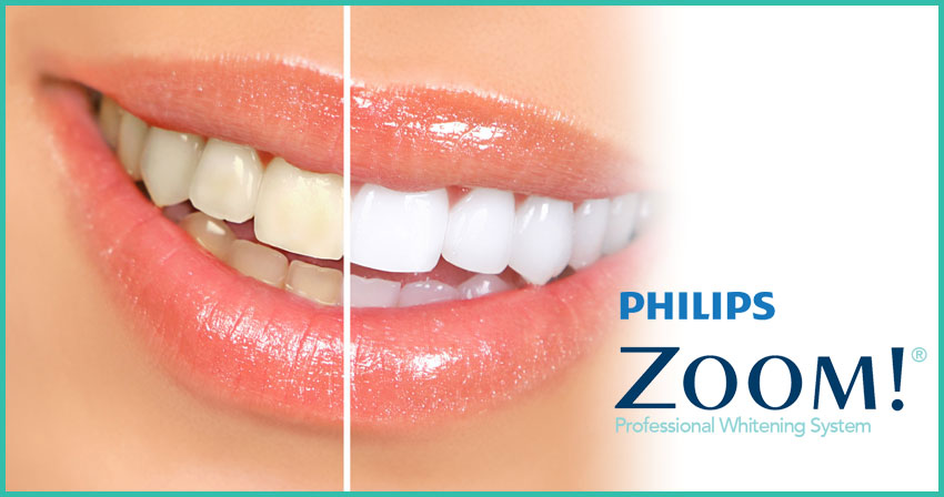 plano-teeth-whitening-dentist-dental-studio-121