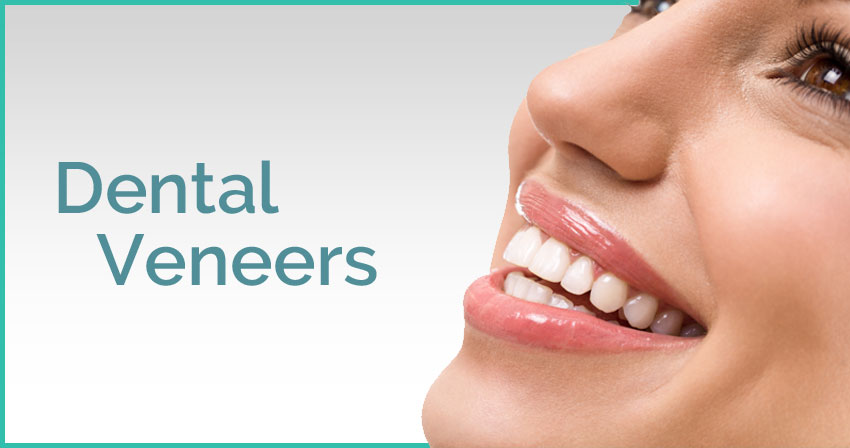 Porcelain Veneers in Plano